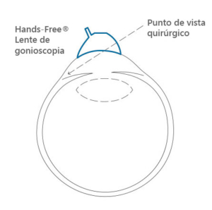 lentes de gonioscopia